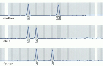 三个图显示哪些同功酶电泳凝胶三名家庭成员之间共享。每个凝胶看起来像一个长水平较小的灰色矩形垂直灰色和白色矩形重叠。蓝线,看起来像一个色谱图叠加在凝胶和代表个人同工酶凝胶上的每个位置连接起来。母亲的凝胶在顶部有一个标记点6和9.3。孩子的凝胶在图6和7点上一个标记。所谓的父亲的凝胶底部有一个标记点7和9。