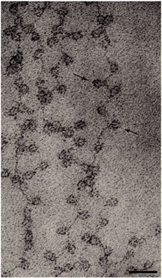 电子灰度图片显示了染色质扩展形式,类似于珠子一个字符串。珠子是核小体,字符串是DNA。每一个核小体看起来像一个黑色小圆。许多圆圈是可见的交替的一长串DNA。两个核小体与黑色的箭头表示。规模酒吧代表30纳米。每个核小体直径大约10纳米。
